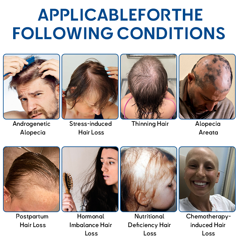 ✅Official Store: Croaie® STEM Cell Hair Cycle Roller