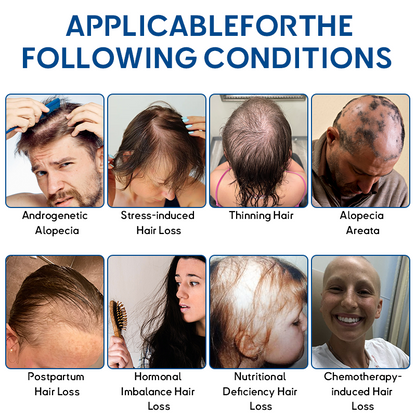 ✅Official Store: Croaie® STEM Cell Hair Cycle Roller