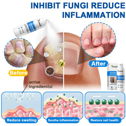 ✅ Official Store: Cvreoz® Magnesium Herbal Psoriasis Spray 👨‍⚕️ MHRA Approved (Relieves psoriasis and eczema, improves bacterial infections in the genital area, treats acne and warts)