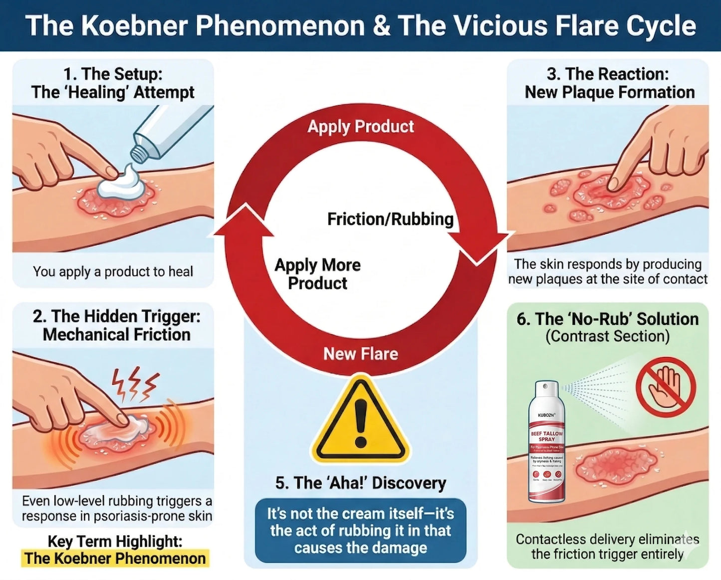 Understanding Koebner Phenomenon and psoriasis triggers - the science behind relief