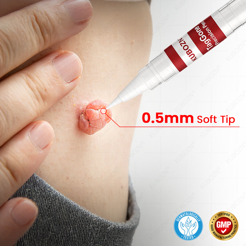 ✨KUBOZN® TagGone Precision Pen (2026 Upgrade) | Skin Tag, Mole & Wart Remover – Fast, Gentle & Scar-Free in 5 Days (offer)