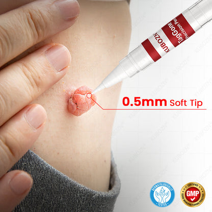 ✨KUBOZN® TagGone Precision Pen (2026 Upgrade) | Skin Tag, Mole & Wart Remover – Fast, Gentle & Scar-Free in 5 Days (offer)