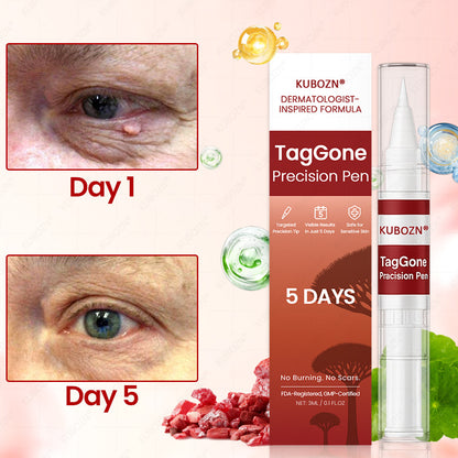 ✨KUBOZN® TagGone Precision Pen (2026 Upgrade) | Skin Tag, Mole & Wart Remover – Fast, Gentle & Scar-Free in 5 Days (offer)